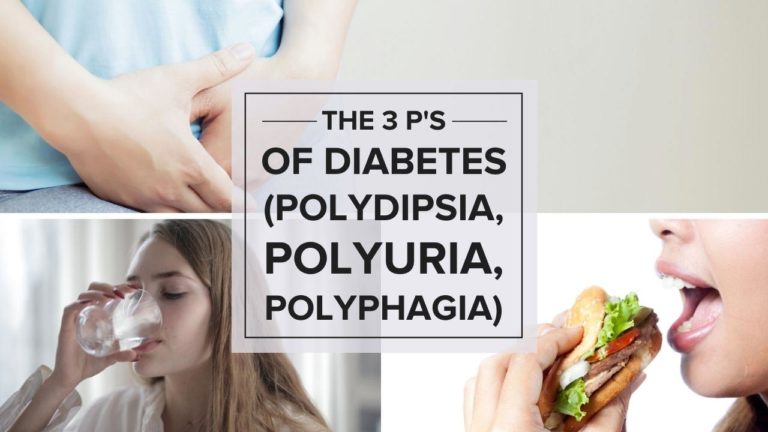 the-3-p-s-of-diabetes-polydipsia-polyuria-polyphagia