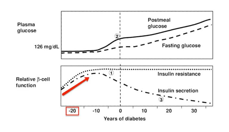 The C-Peptide Test – The Most Important Blood Test for Diabetes